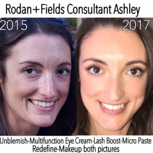 Rodan+Fields Skin Care Holiday Gift Ideas south shore Boston 